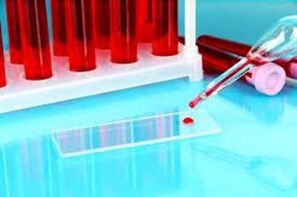Hemuskania dei rifiuti di sangue per i parassiti