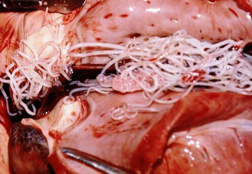 Parassiti nel corpo umano
