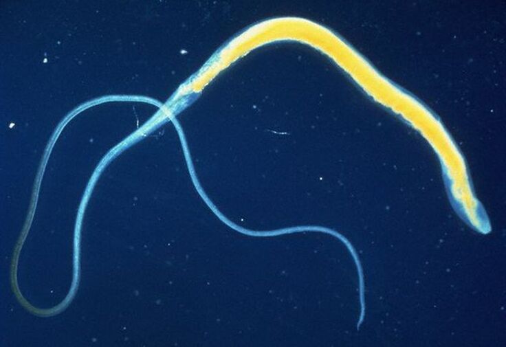 Il tricocefalo è un comune parassita intestinale.