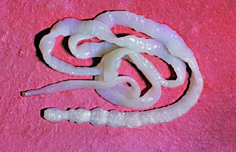 La tenia del manzo è un verme intestinale comune.