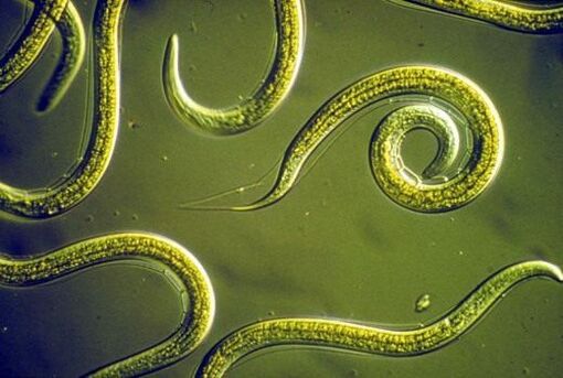 Nematodi parassiti che vivono nell'intestino tenue umano