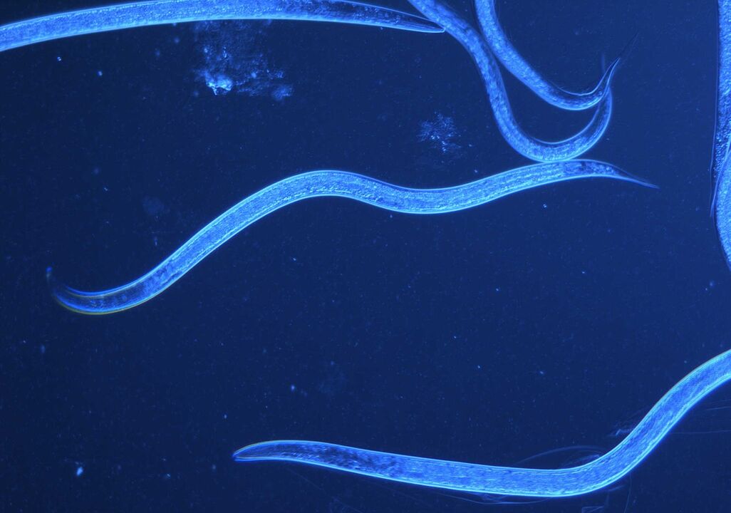 tricocefalo umano