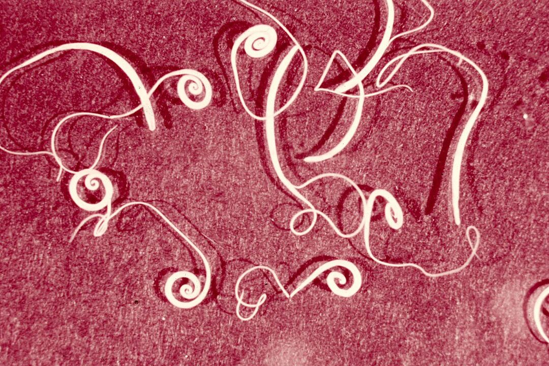 vermi umani di Trichinella